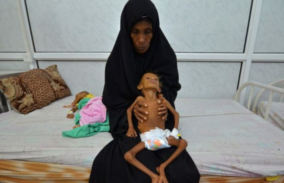 La guerra de agresión de la OTAN árabe y el hambre matan en Yemen un niño o niña cada diez minutos