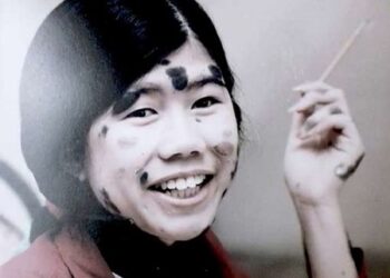 Premiado documental vietnamita sobre víctima de agente naranja