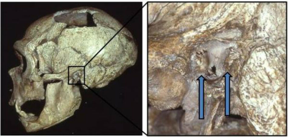 El oído de surfista era común entre los neandertales