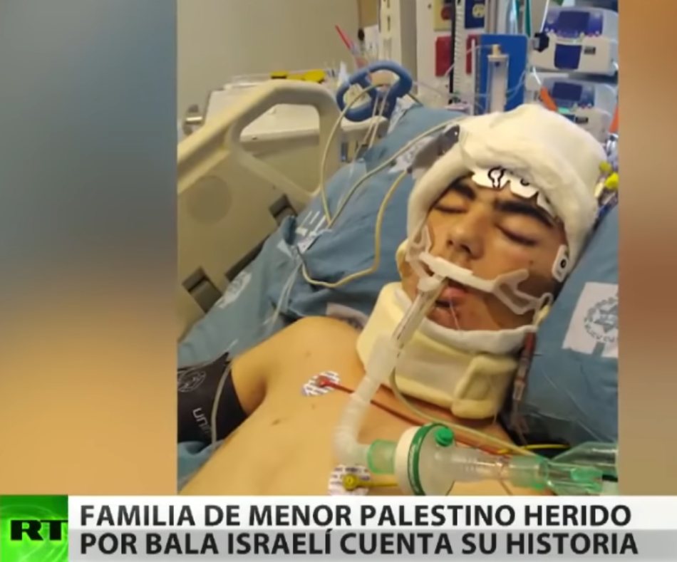 Un niño palestino queda en coma tras ser baleado en la cabeza por un soldado de Israel mientras jugaba en la calle