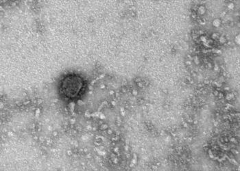 Nuevo avance: Expertos rusos descifran el genoma del coronavirus