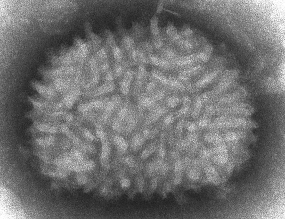 La búsqueda de una vacuna para el coronavirus a partir del virus que erradicó la viruela