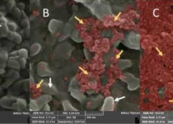 Científicos cubanos captan primeras imágenes del virus SARS-CoV-2