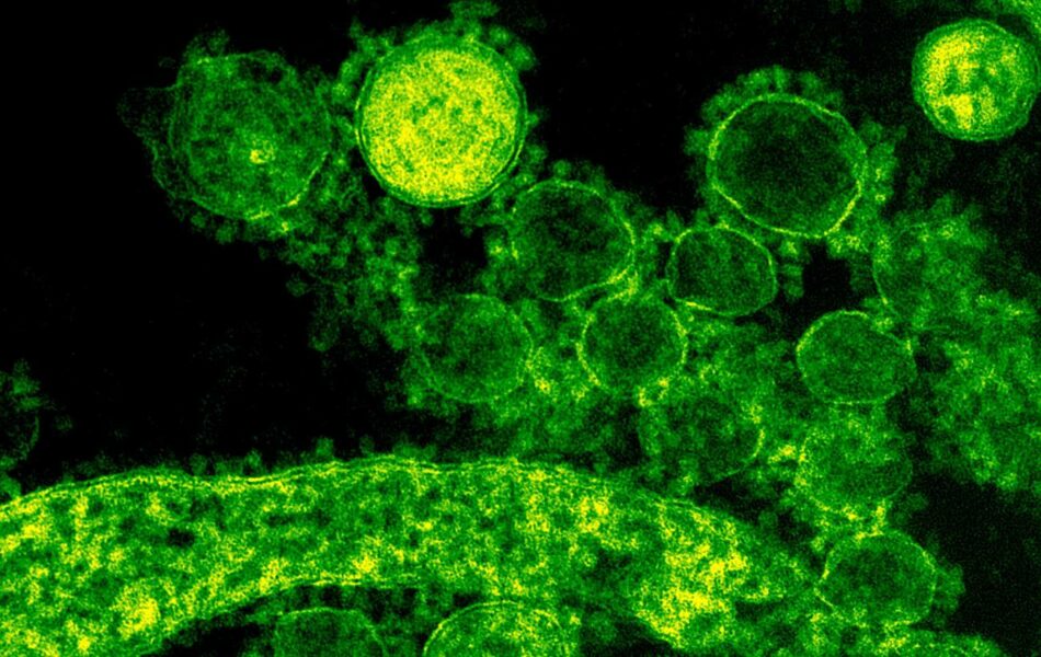 Dos vías para producir anticuerpos contra el coronavirus de forma ultrarrápida