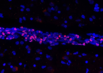 Descubren que el virus causante de la COVID-19 provoca la muerte de importantes células del sistema vascular cerebral