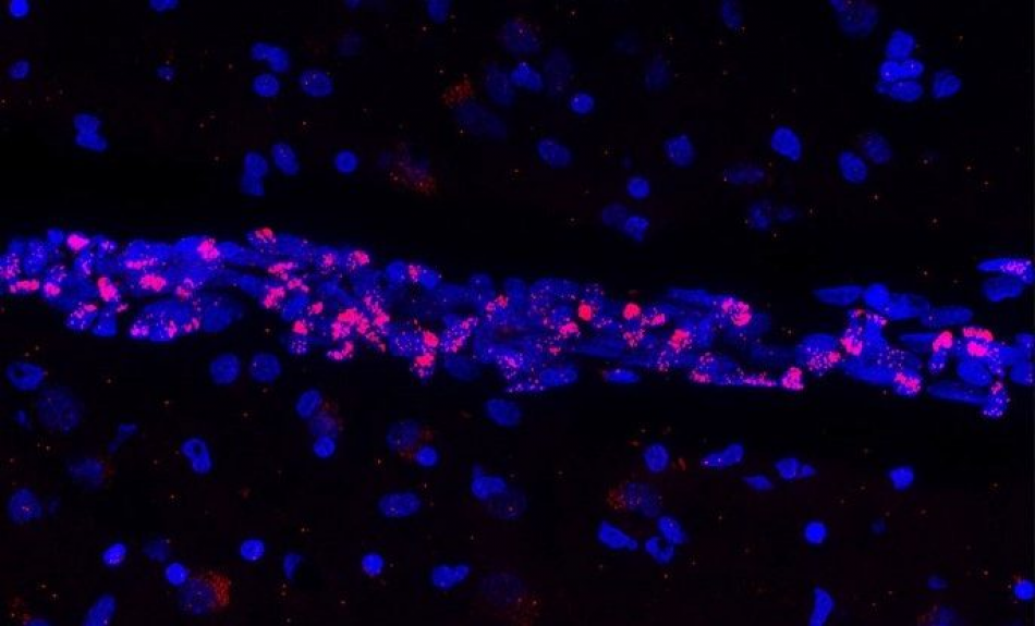 Descubren que el virus causante de la COVID-19 provoca la muerte de importantes células del sistema vascular cerebral