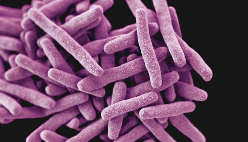 Las muertes por tuberculosis aumentan por primera vez en más de una década por la covid