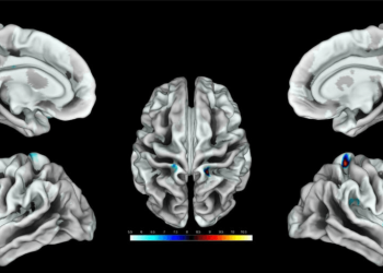 Así responde el cerebro femenino a la estimulación genital