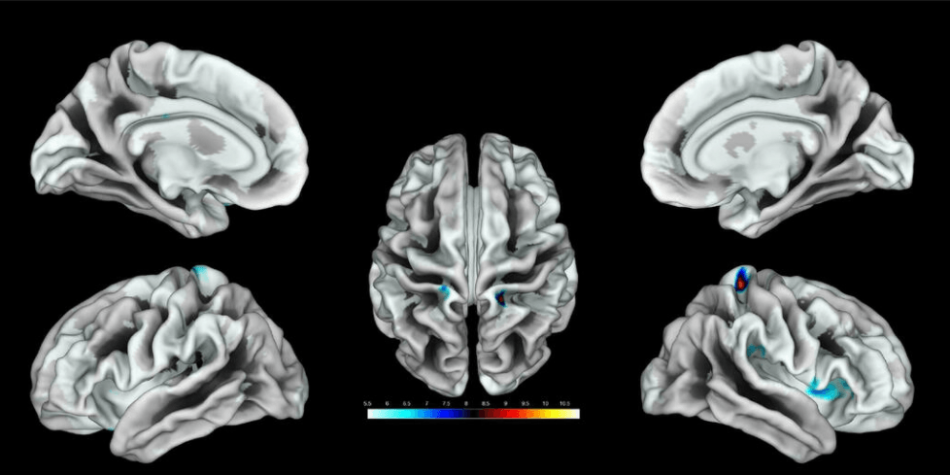 Así responde el cerebro femenino a la estimulación genital