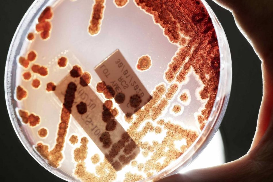 Las infecciones por bacterias multirresistentes causan más muertes que el sida o la malaria