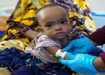 Más de 350.000 niños en Somalia podrían morir por desnutrición