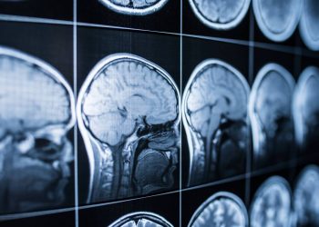 El cerebro humano sigue su construcción después de nacer