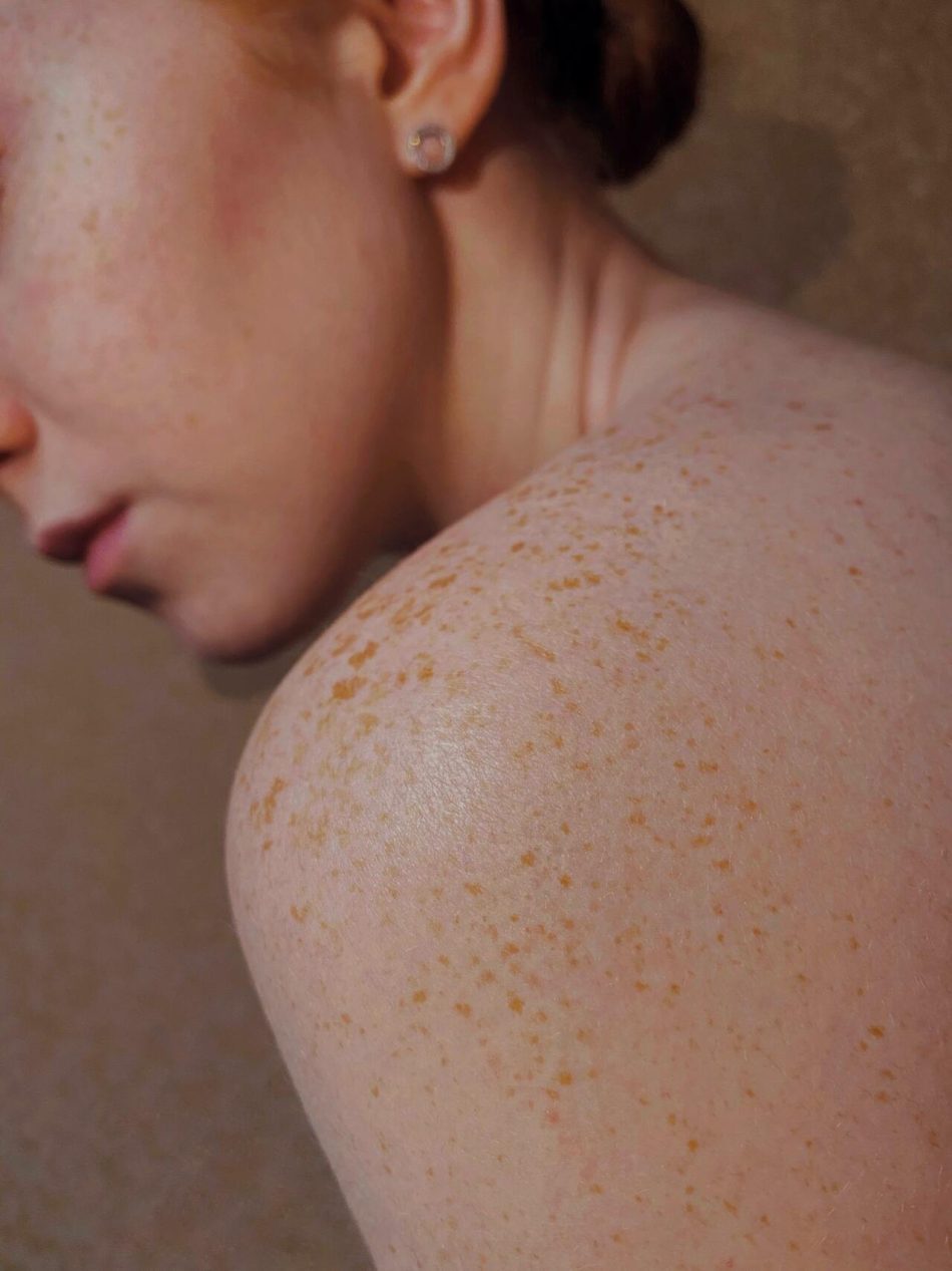 ¿Por qué necesitas un dermatólogo online?