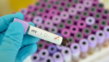 España reduce casi a la mitad la tasa de infecciones de VIH no diagnosticadas