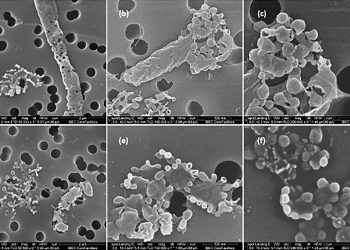 Cómo mejorar los antibióticos y diseñar nuevos tratamientos antimicrobianos