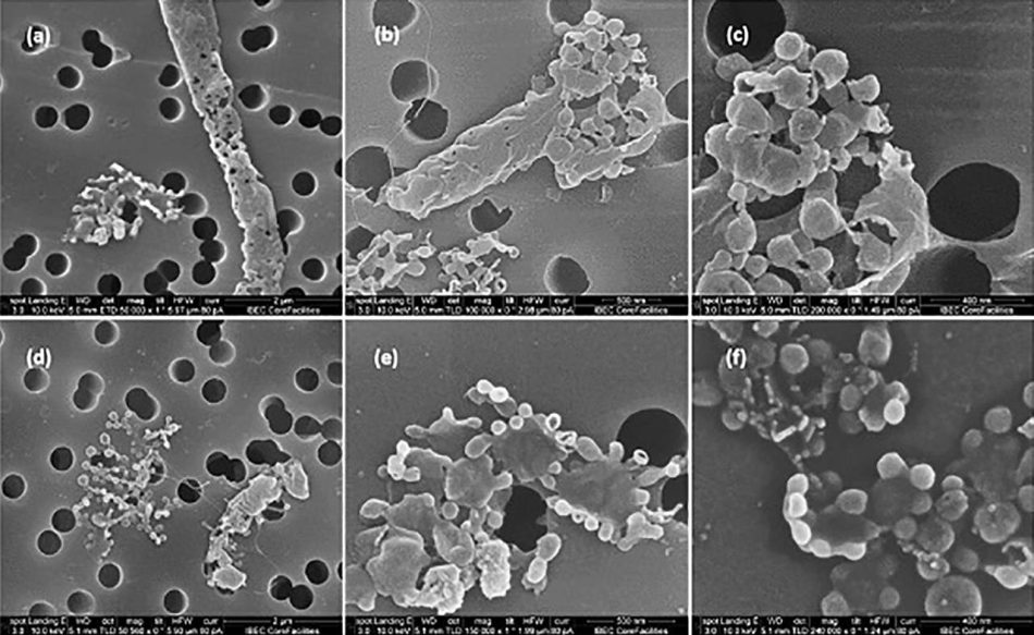 Cómo mejorar los antibióticos y diseñar nuevos tratamientos antimicrobianos