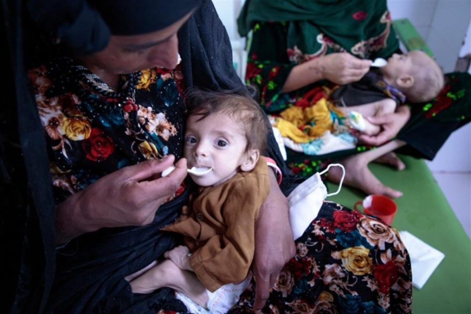 La desnutrición alcanza máximos históricos en Afganistán