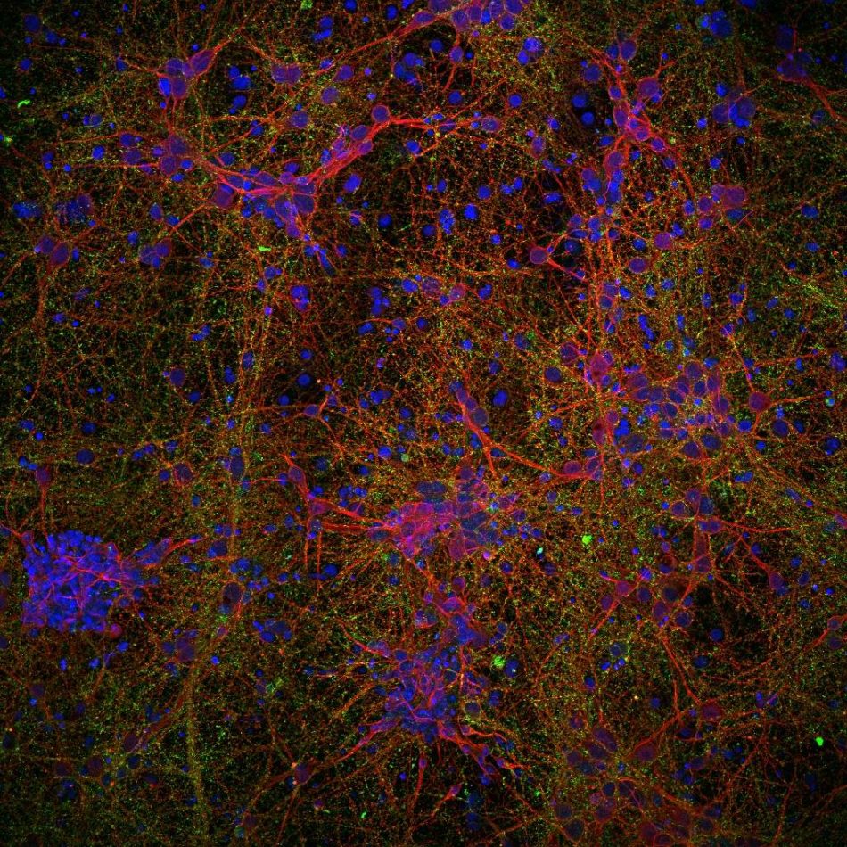 Investigadores del CSIC utilizarán nanotecnología para reparar lesiones medulares