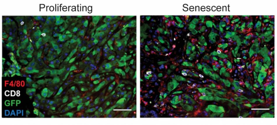 La senescencia abre una nueva diana terapéutica contra los tumores