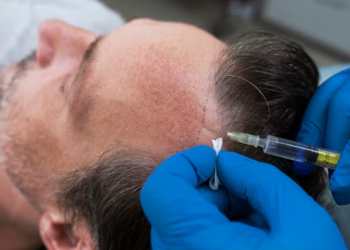 Cuida la salud del cabello en clínicas capilares