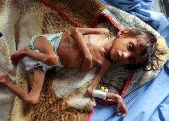 Desnutrición amenaza a 4,5 millones de niños yemenitas