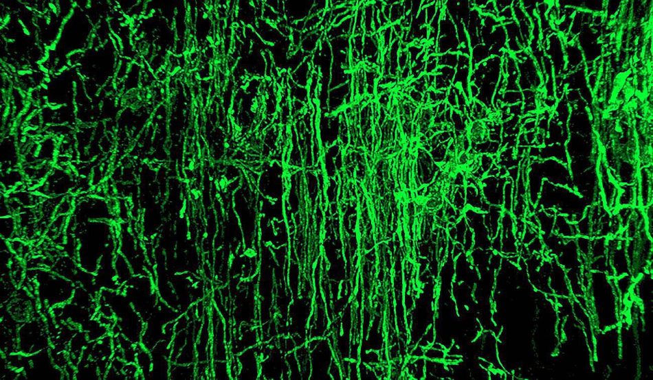 Antiguos virus desempeñaron un papel clave en la evolución del cerebro de los vertebrados