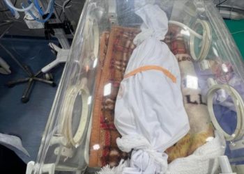 17 niños muertos en Gaza por desnutrición, la cifra crece y crece