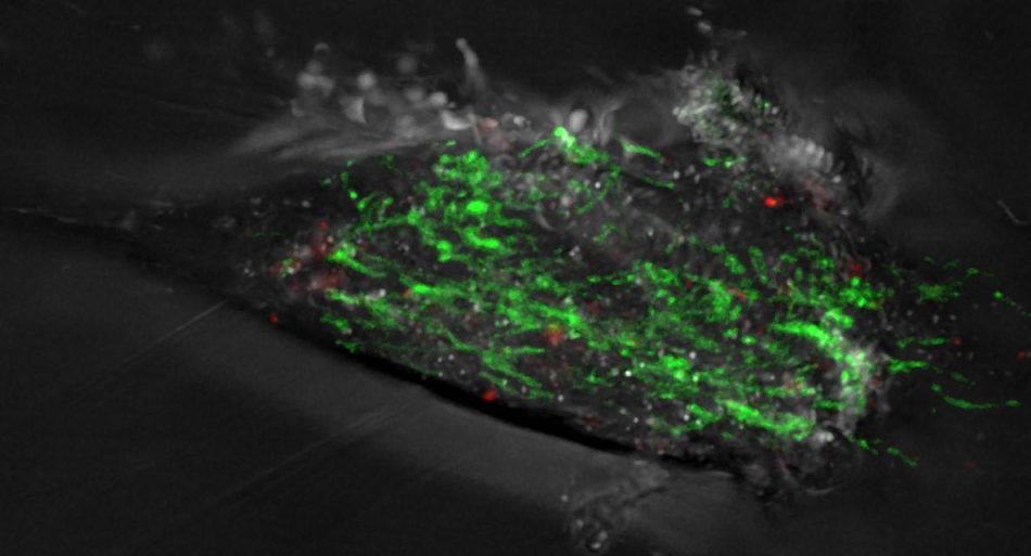 Las mutaciones del ADN mitocondrial podrían anunciar el inicio del párkinson