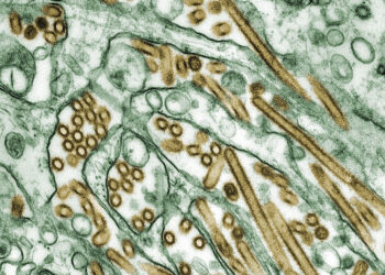 Emergencia sanitaria en California por el primer caso grave de gripe aviar en humanos