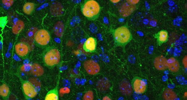 Descubren qué neuronas están implicadas en la ansiedad y el aislamiento social