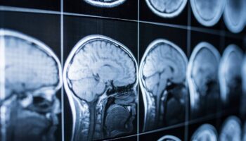 Identifican las células que generan nuevas neuronas en el cerebro adulto humano