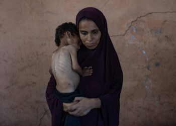 Las hambrunas como la que impone Israel a Palestina tienen efectos que duran generaciones