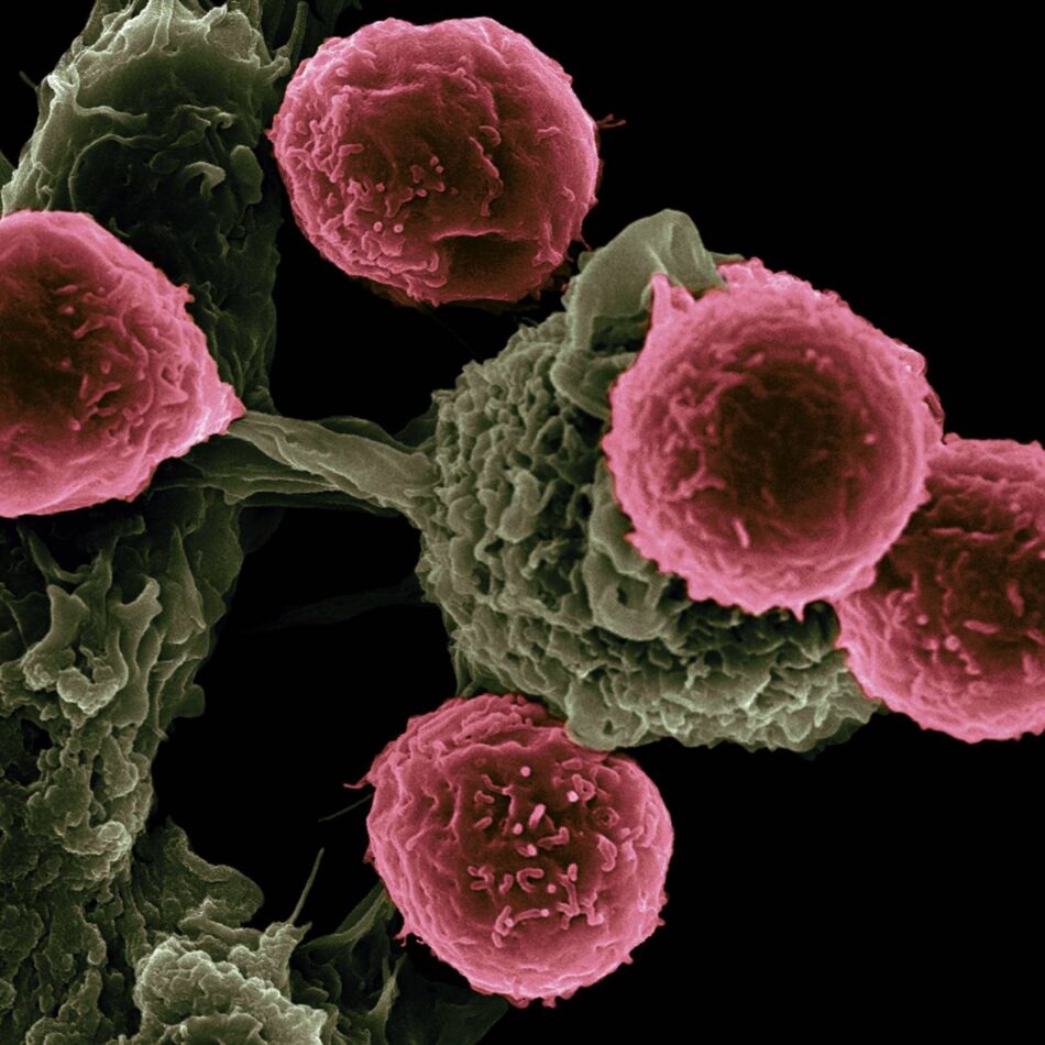 Una nueva vacuna muestra potencial para prolongar la supervivencia en cáncer de páncreas y colon