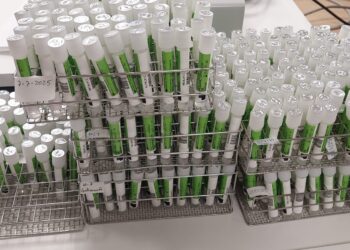 CCOO denuncia la precariedad en el Laboratorio de Microbiología en el Hospital de Jerez