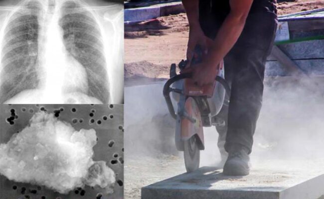 CCOO advierte que España sufre una reemergencia de la silicosis en el siglo XXI