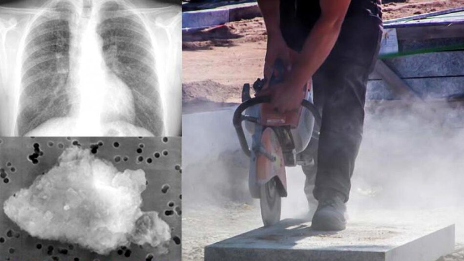 CCOO advierte que España sufre una reemergencia de la silicosis en el siglo XXI