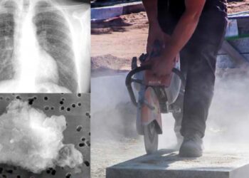 España sufre una reemergencia de la silicosis en el siglo XXI