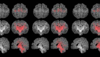 La contaminación atmosférica afecta a la maduración cerebral del bebé