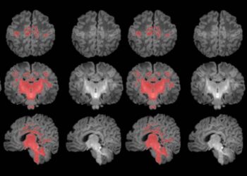 La contaminación atmosférica afecta a la maduración cerebral del bebé
