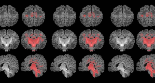 La contaminación atmosférica afecta a la maduración cerebral del bebé