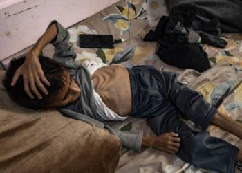Más de 54.000 niños en Gaza necesitan atención médica urgente por desnutrición severa