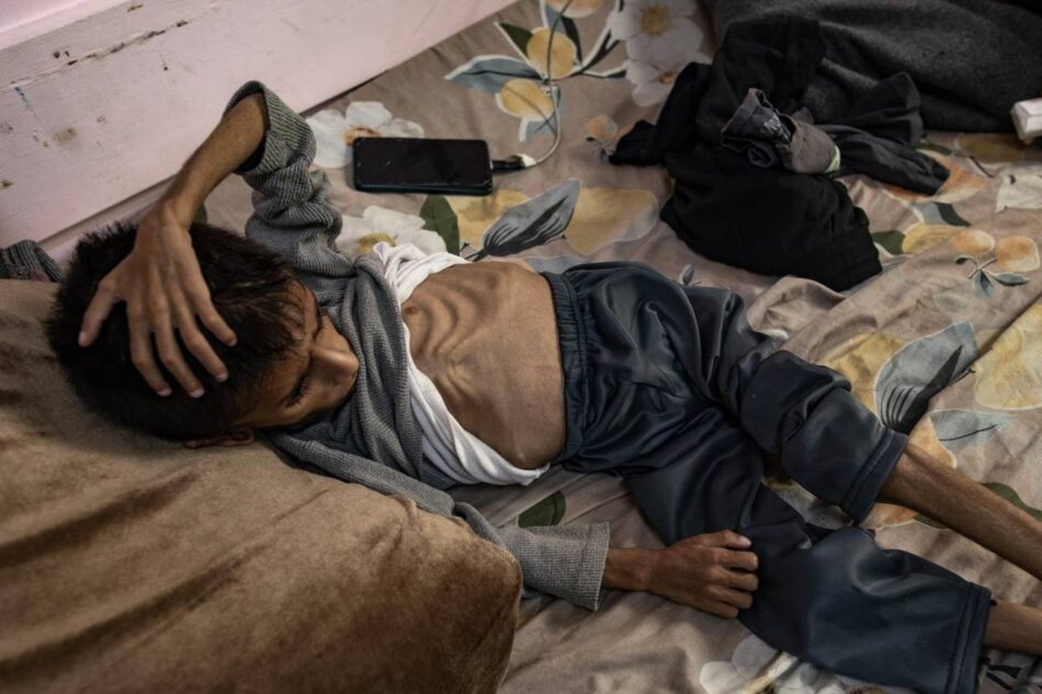 Más de 54.000 niños en Gaza necesitan atención médica urgente por desnutrición severa