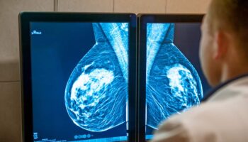 Otra negligencia del Servicio Andaluz de Salud: 16 meses de espera para ser citada después de que le descubrieran un nódulo en el pecho