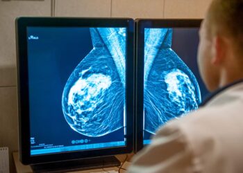 Otra negligencia del Servicio Andaluz de Salud: 16 meses de espera para ser citada después de que le descubrieran un nódulo en el pecho