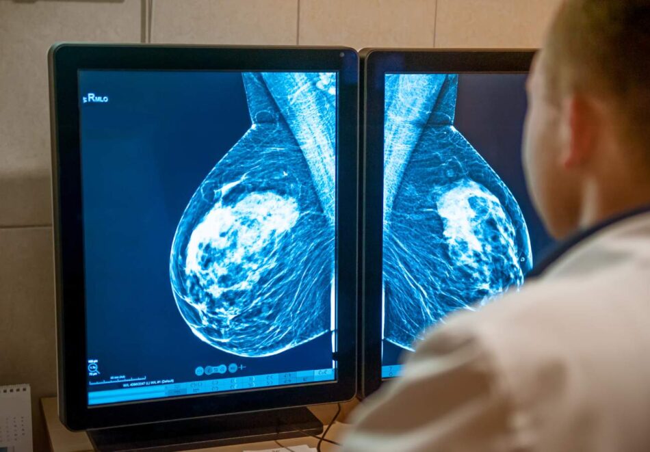 Otra negligencia del Servicio Andaluz de Salud: 16 meses de espera para ser citada después de que le descubrieran un nódulo en el pecho