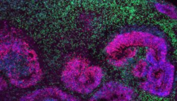 El mayor mapa del cerebro en desarrollo revela las fases en las que se originan los trastornos neurológicos