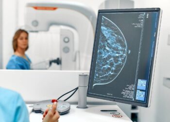 Una densidad mamográfica alta podría estar asociada con tumores de peor pronóstico