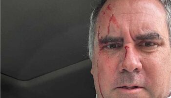 Atacan a balazos a candidato presidencial de Perú