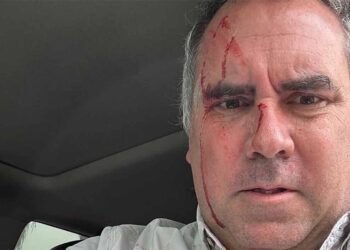 Atacan a balazos a candidato presidencial de Perú