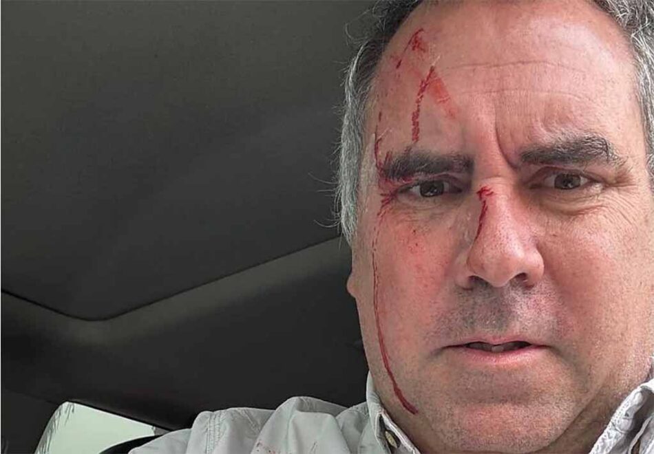 Atacan a balazos a candidato presidencial de Perú